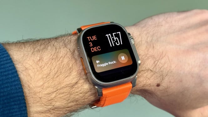 Risih Live Activities Muncul Terus di Apple Watch? Ini Solusinya