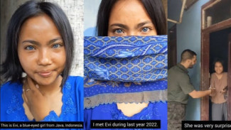 Wanita Beramata Biru Asal Jawa Barat Viral Sampai ke Luar Negeri, Ini Sosoknya