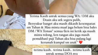 Lady Nayoan Perlihatkan Luka-luka yang Ada di Tangan dan Kaki Akibat Kecelakaan