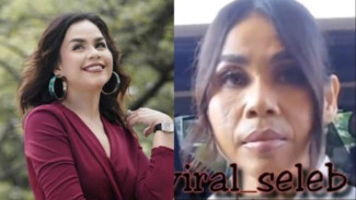 Wajah Melaney Ricardo Tak Mulus di Kamera Wartawan, Netizen: Sengaja Kali..