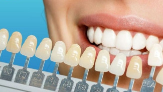 Tips Putihkan Gigi Tanpa Pasta Gigi Mahal, Hasilnya Bikin Kaget