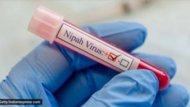 Virus Nipah