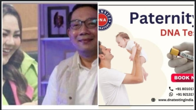 Tes DNA Ridwan Kamil Lisa Mariana