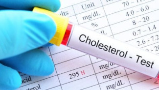 Cara Turunkan Kolesterol Tanpa Obat