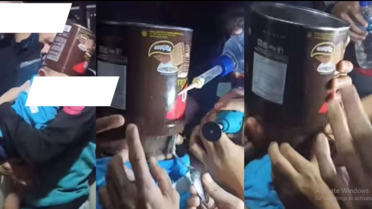 Kaleng biskuit nyangkut di kepala seorang bocah