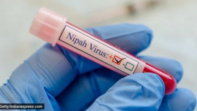 Virus Nipah