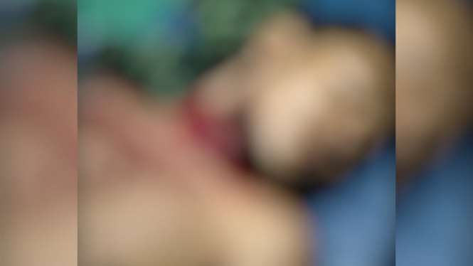 Pria di Mojokerto Ditemukan Usai Tusuk Leher Pakai Gunting