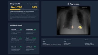 UGM Kembangkan TBScreen.AI untuk Percepat Skrining Tuberkulosis di Wilayah Terpencil