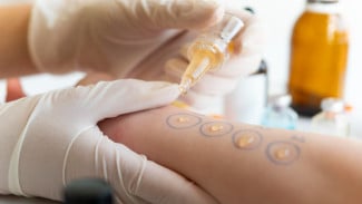 Kasus Alergi Anak Meningkat, Dokter UGM Ingatkan Faktor Risiko dan Pencegahan