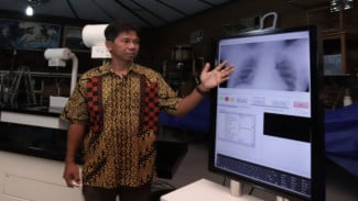 UGM Kembangkan Rumah Skrining dan Radiografi Keliling untuk Percepatan Eliminasi TB