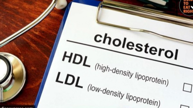 Kolesterol jahat tidak baik untuk kesehatan