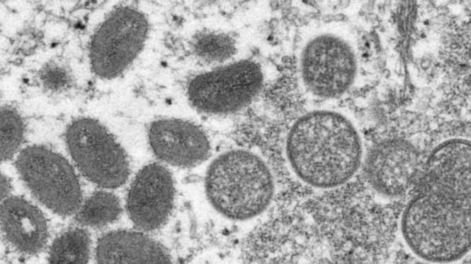 Virus Cacar Monyet