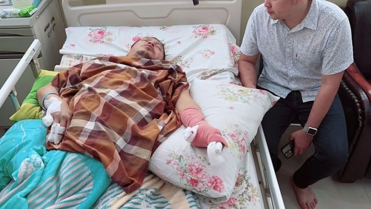 Kondisi Terkini Wakil Bupati Kaur usai Terkena Ledakan Kembang Api