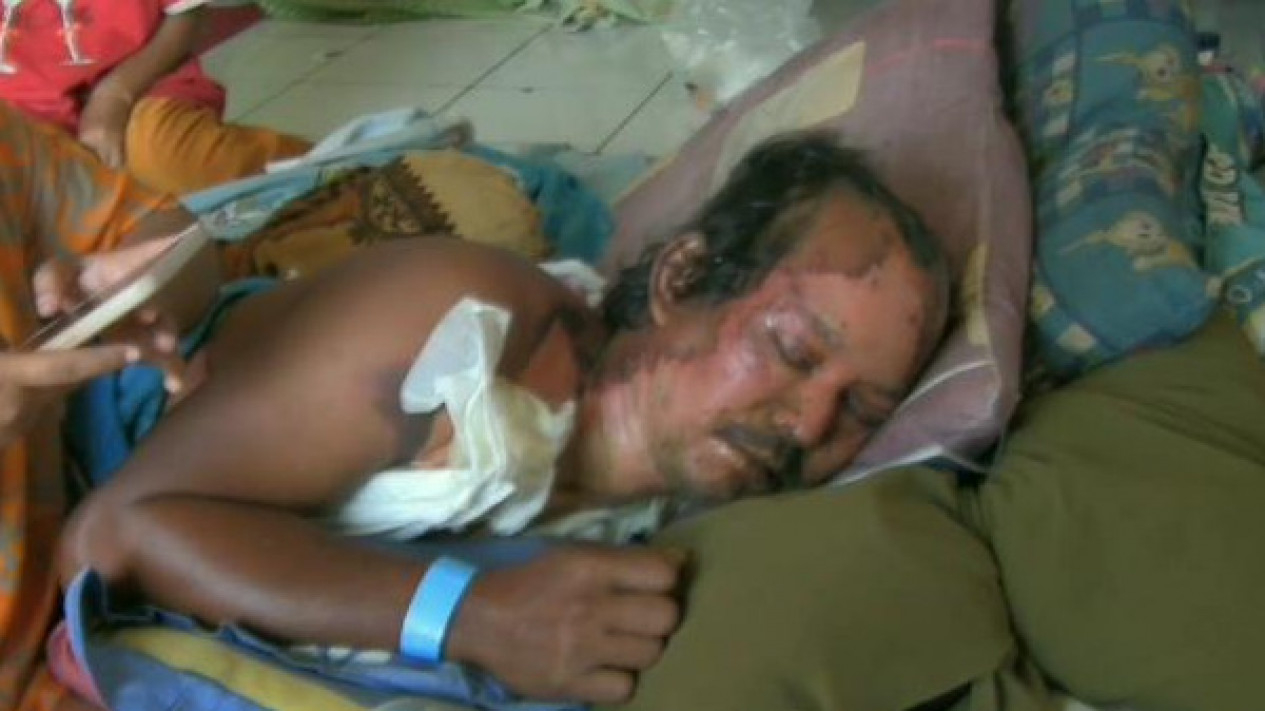Korban tersengat aliran listrik tegangan tinggi mengalami luka bakar.