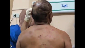Petani di Lampung Barat Diterkam Harimau Saat Mengendarai Motor, Kondisi Korban Stabil