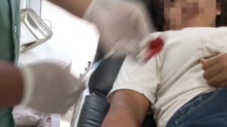 Warga Ratu Abung Diduga Jadi Korban Begal Alami Luka Bacok, Motor Raib Digondol Dua Pelaku