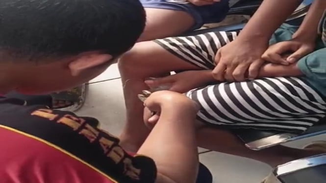 Kaki remaja asal Tajimalela tertancap kail saat mancing belut di sawah.