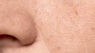 Cara Ampuh Mengecilkan Pori-Pori Wajah Secara Alami!