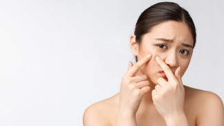 Jerawat Masih Muncul Walau Sudah Rajin Skincare? Ini 5 Alasan yang Tak Terduga