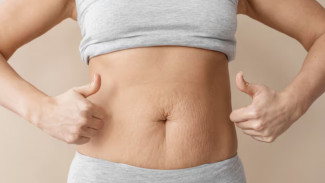 6 Tips Menghilangkan Stretch Mark dengan Cara Alami dan Aman, Simak Langkah-langkahnya!