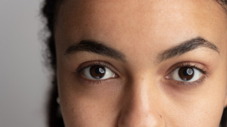 Eye Cream vs. Bahan Alami: Mana yang Lebih Cocok untuk Mata Panda?
