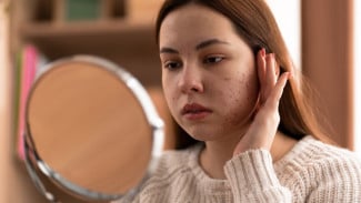 Mengapa Kulit Sering Bermasalah saat Cuaca Berubah? Ini Penjelasan Dokter
