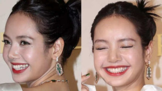 Pengen Pamer Tooth Gems Kayak Lisa BLACKPINK? Ini 7 Hal yang Harus Diperhatikan