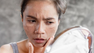 7 Kesalahan Makeup Sebabkan Flek Hitam, Wajib Dihindari Kalau Gak Mau Kelihatan Tua