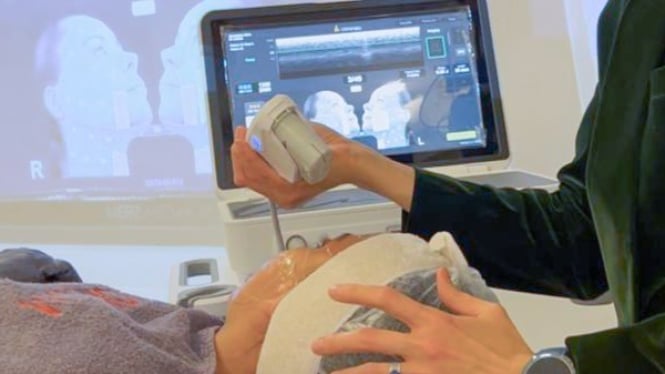 Metode Ultherapy