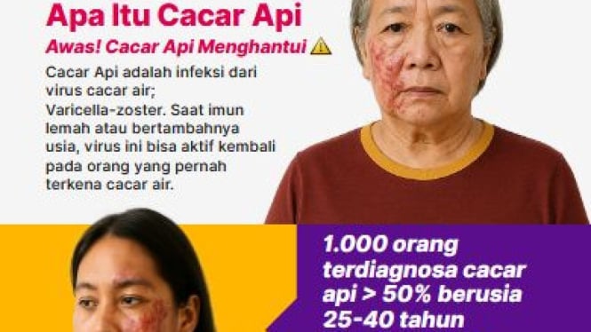 Ilustrasi wabah penyakit cacar api