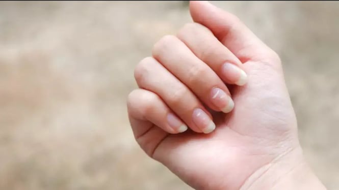 Bintik putih pada kuku penanda kesehatan