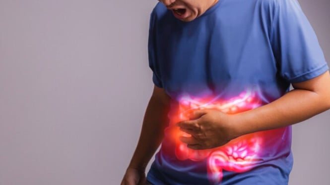 Ilustrasi Penyakit Radang Usus (IBD)