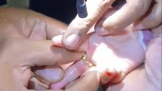 Aksi Heroik Petugas Damkar, Jari Balita di Sampang Berhasil Dievakuasi Dari Jepitan Cincin
