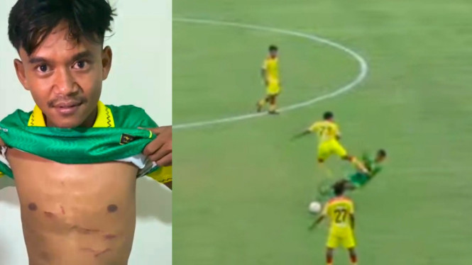 Laga Liga 4 di Bangkalan Berujung Cedera Serius