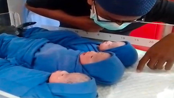 Ketiga bayi kembar dimomentum hari Kartini di Bangkalan Madura