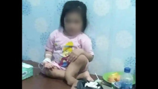 Bocah di Nias Selatan yang Viral Diduga Dianiaya, Polisi Tetapkan Tante Korban Jadi Tersangka