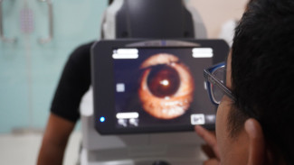 100 Pasien Katarak Bakal Dapat Operasi Gratis dari SMEC Pekanbaru