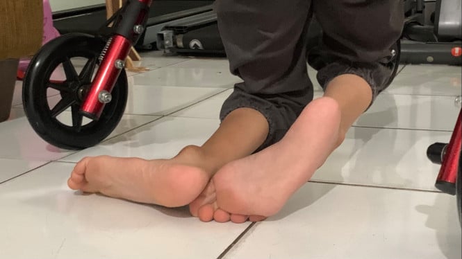 Anak berkebutuhan khusus.