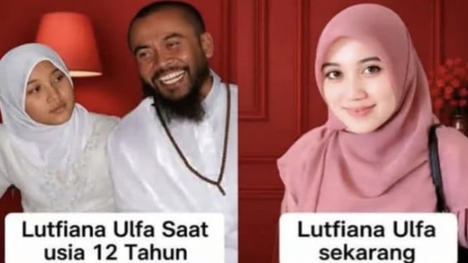 Transformasi Lutfiana Ulfa dulu dan sekarang.