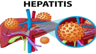 Temuan Kasus Hepatitis, Kenali Bahaya dan Cara Penularannya