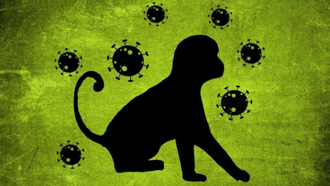 Ilustrasi penyakit cacar monyet.