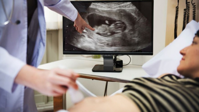 Ilustrasi dokter mengecek kondisi kandungan ibu hamil.