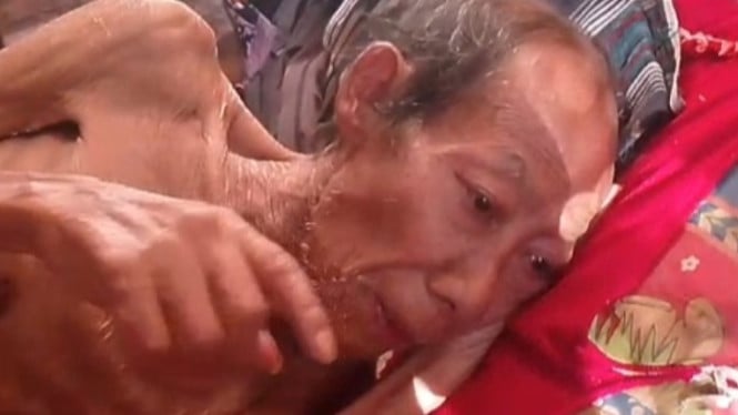Tumin, lansia sebatangkara dalam kondisi sakit parah