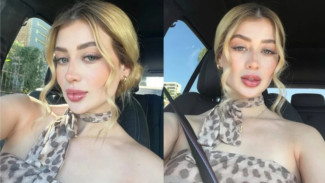 Beauty Influencer Meksiko Tewas Ditembak Saat Siaran Langsung