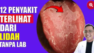 12 Rahasia Tubuh yang Terungkap dari Lidah, Nomor 7 Paling Mengejutkan!