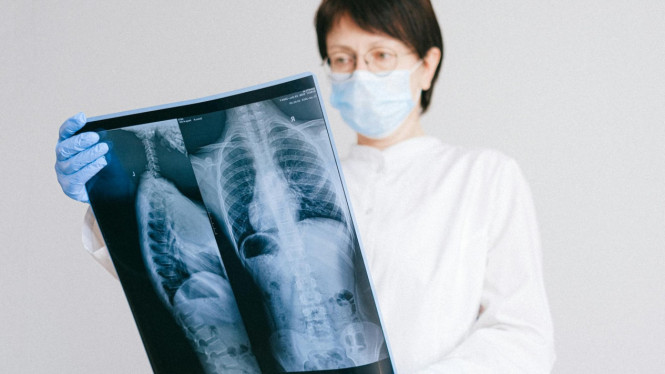 Dokter memeriksa hasil scan Paru-Paru.