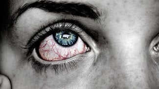 Mata Merah Iritasi? Ini 6 Cara Ampuh Mengatasinya dalam Sekejap!