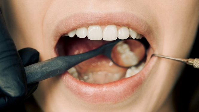 Ilustrasi kesehatan mulut dan gigi
