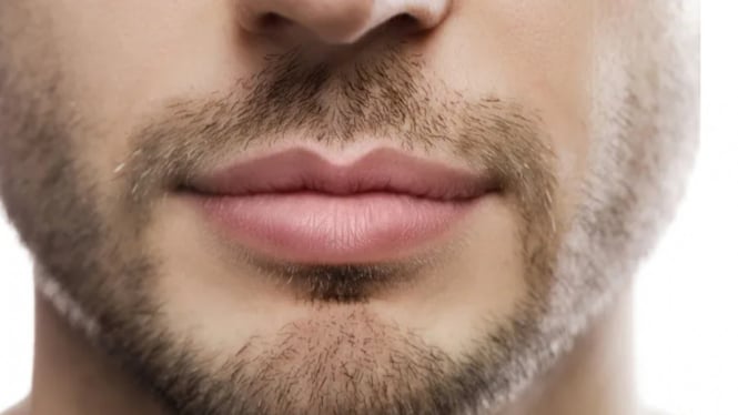 Tips Menyembuhkan Bibir Hitam Akibat Rokok
