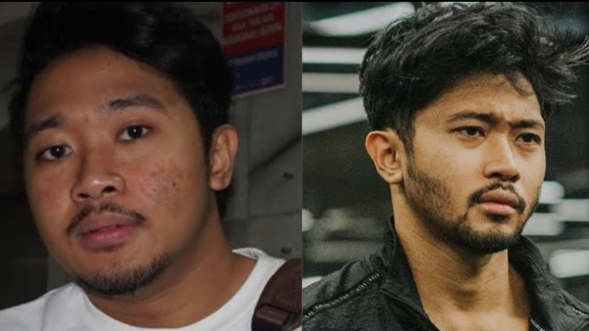 Rahasia Kulit Bebas Jerawat